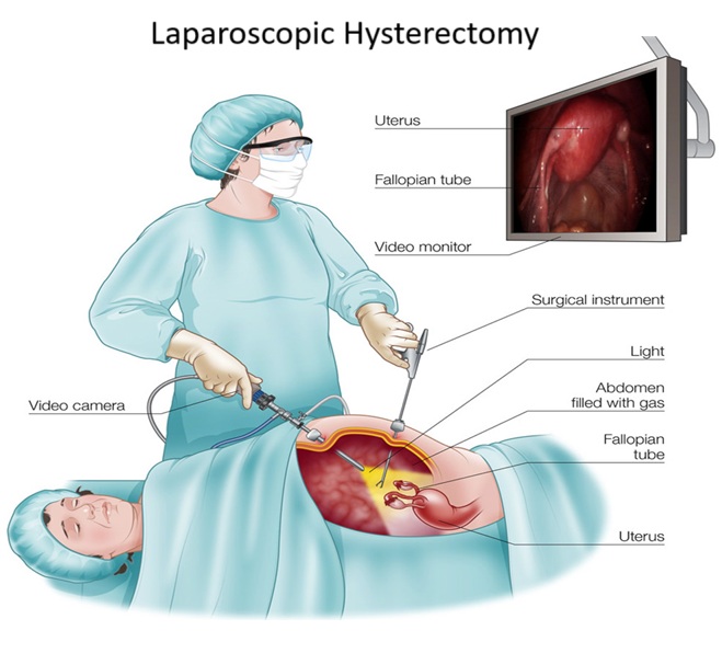International Patient Packages Affordable Hysteroscopy in India