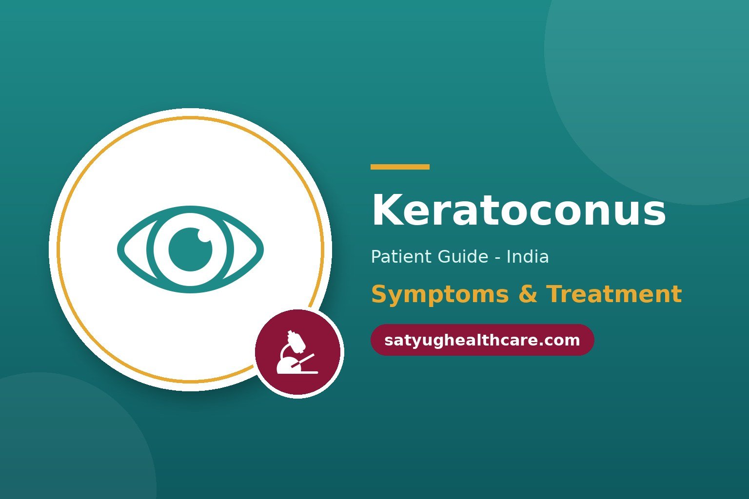 Side view of a cone-shaped cornea in keratoconus