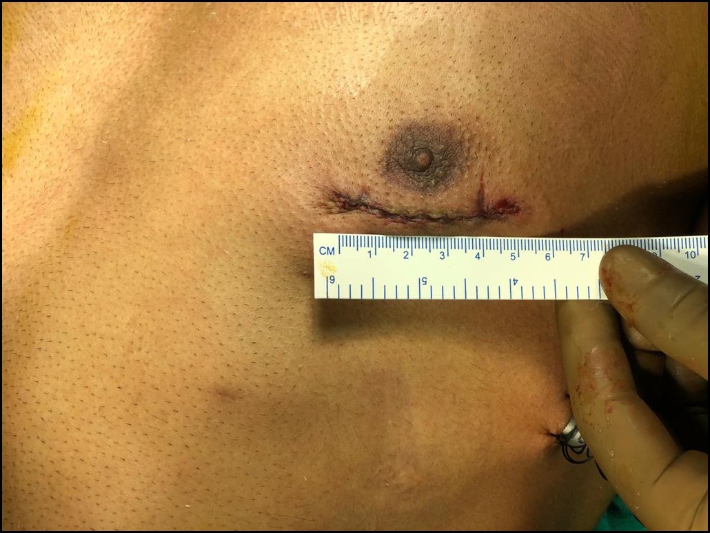 paras hospital cardiac surgery