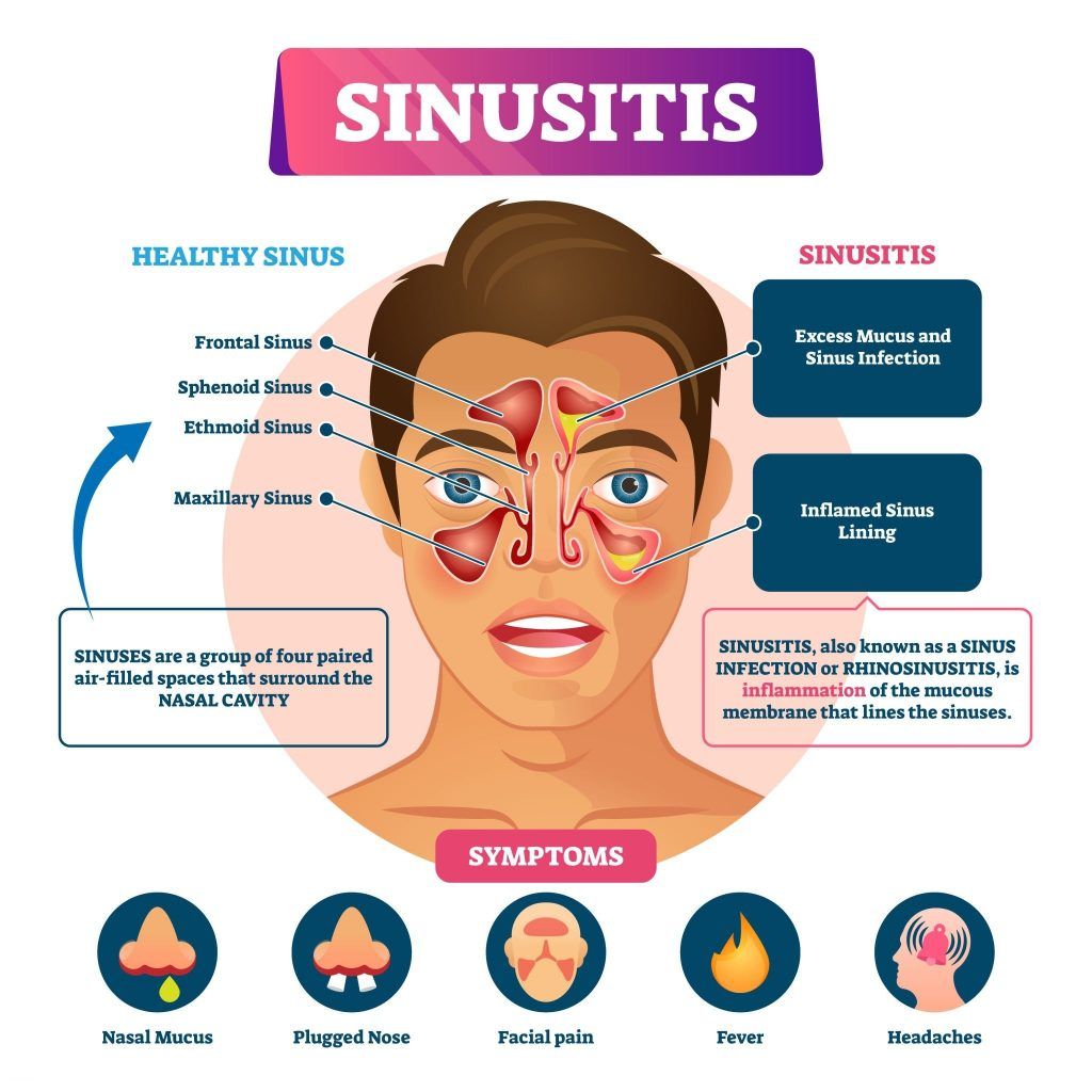 Functional Endoscopic Sinus Surgery (FESS) for sinusitis cost in India