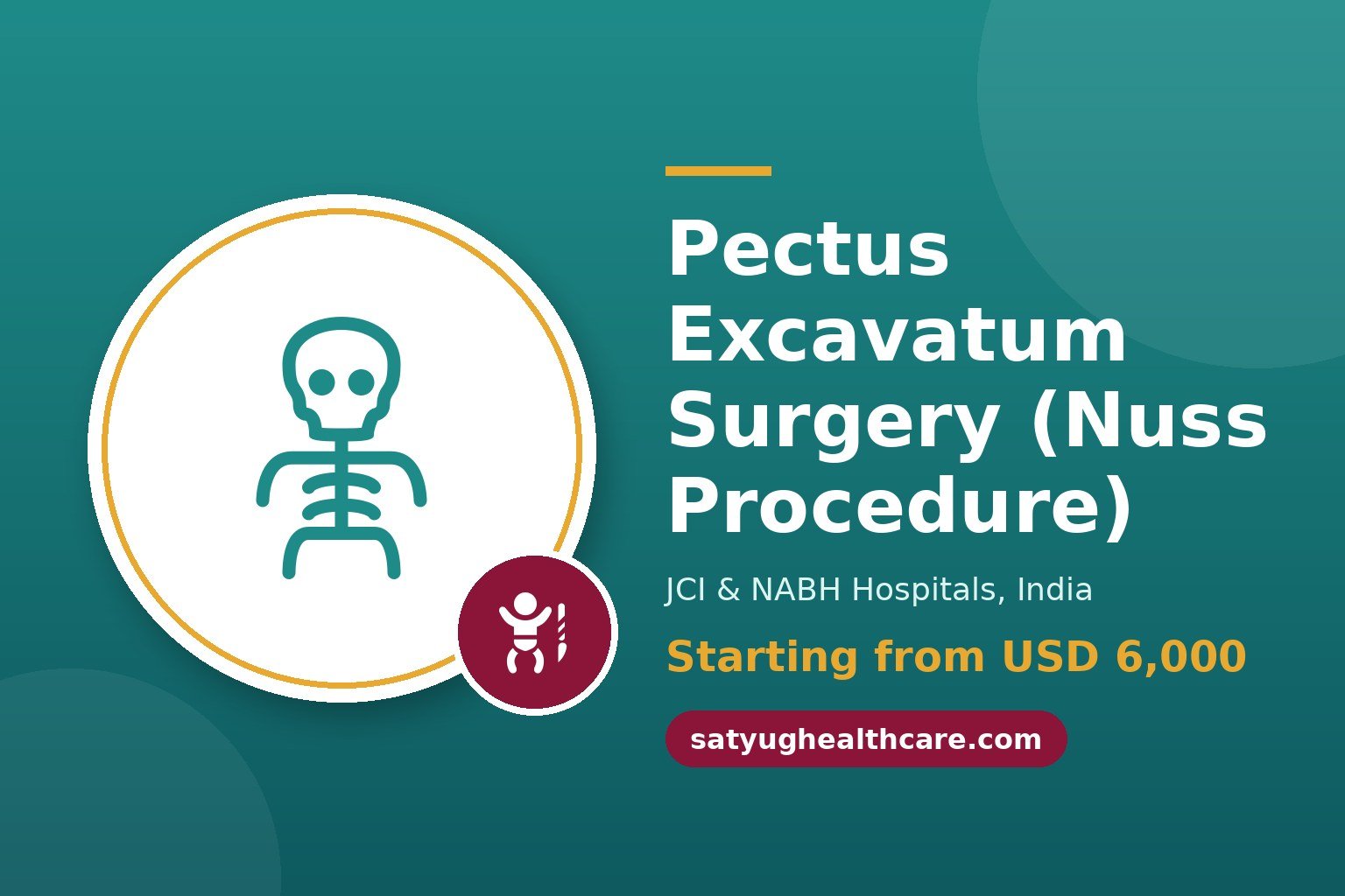 Pectus Excavatum Surgery (Nuss Procedure) Cost in India - Satyug Healthcare