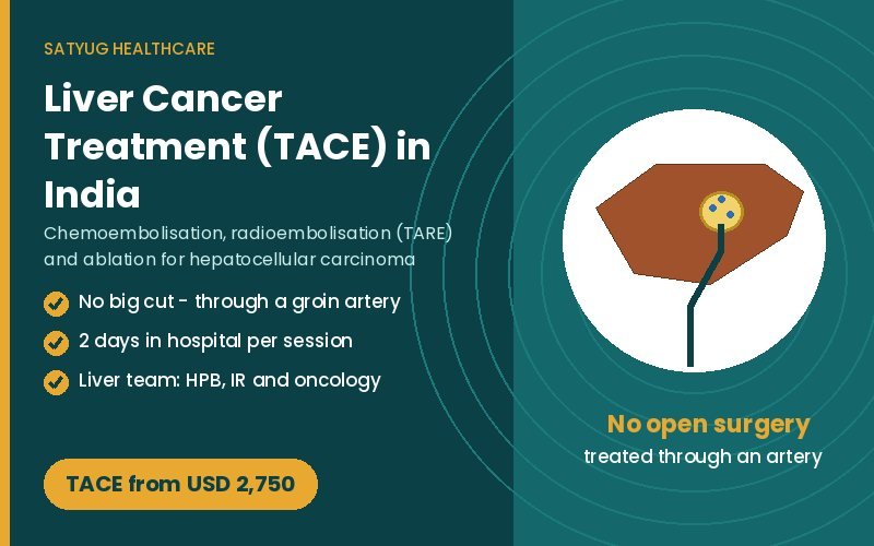 Liver cancer treatment TACE cost in India