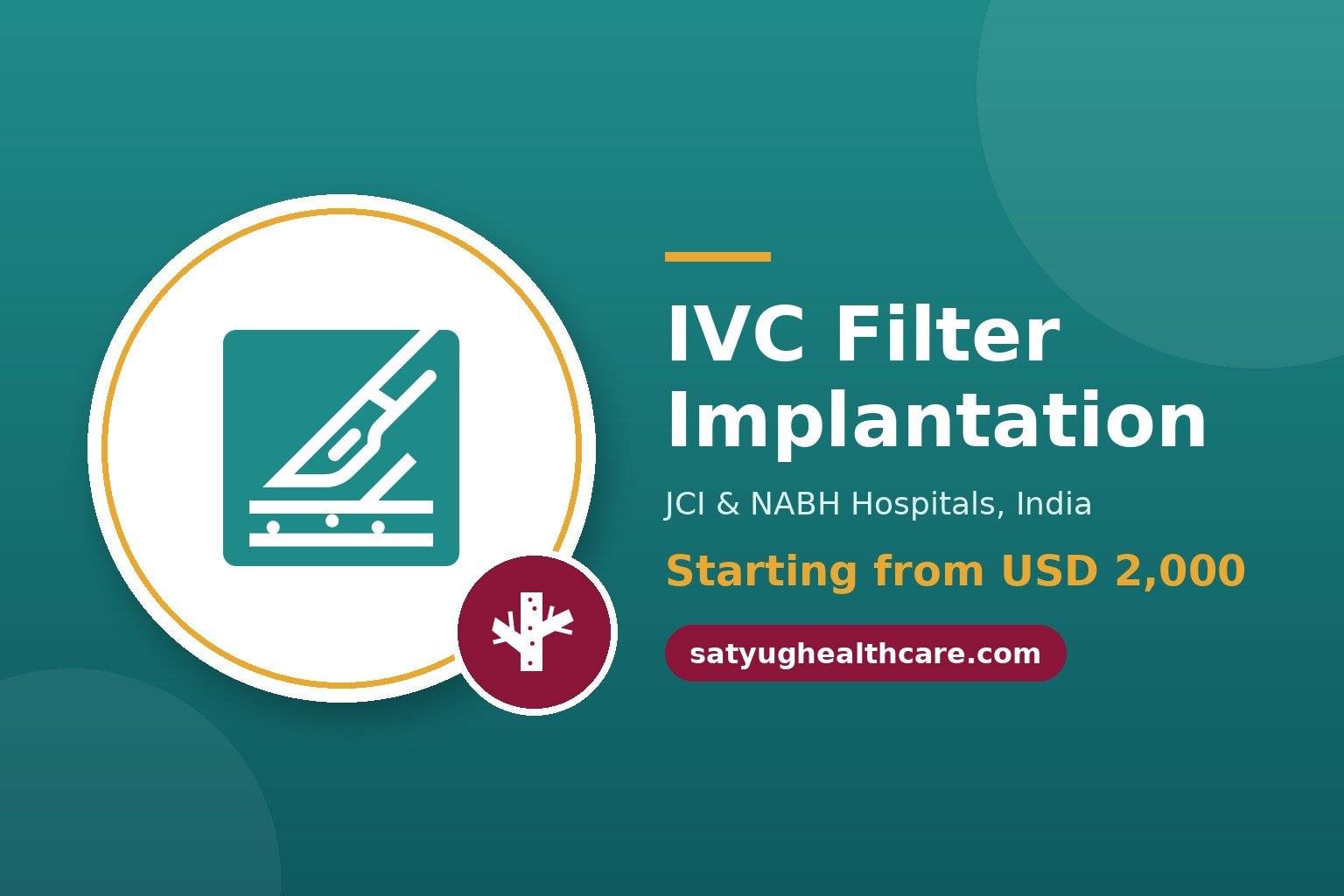 IVC Filter Implantation Cost in India - Satyug Healthcare