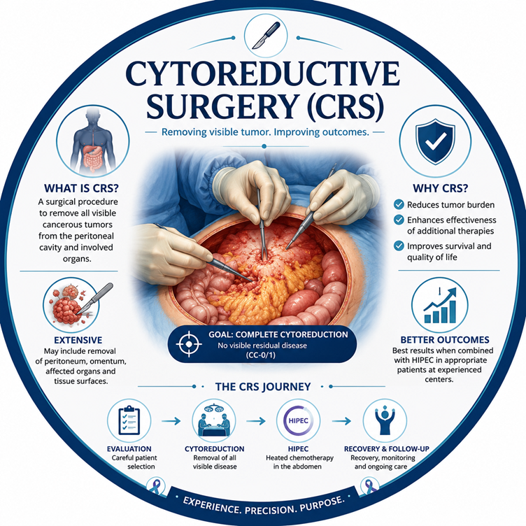 Cytoreductive Surgery CRS Cost in India - Satyug Healthcare