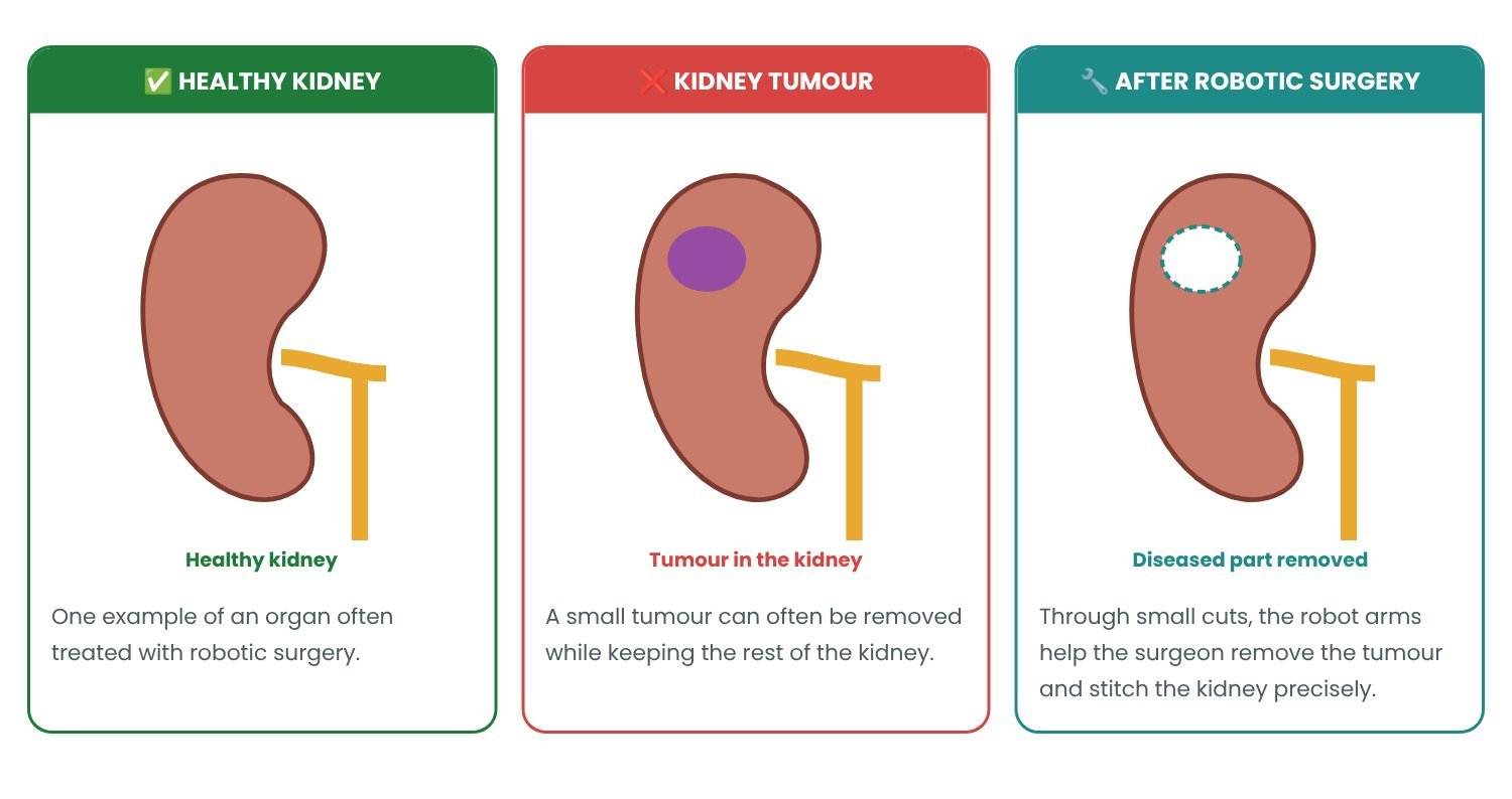 Robotic Surgery: normal vs abnormal explained in pictures Robotic Surgery: normal vs abnormal explained in pictures