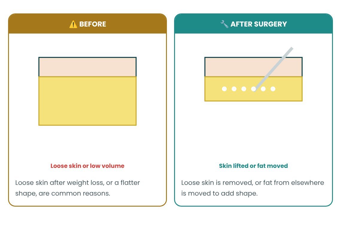 Buttock Lift / BBL: normal vs abnormal explained in pictures