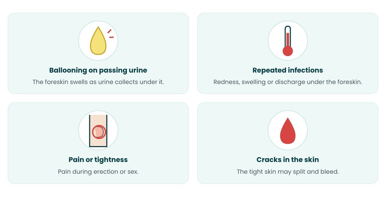 Symptoms that may need Circumcision - in pictures