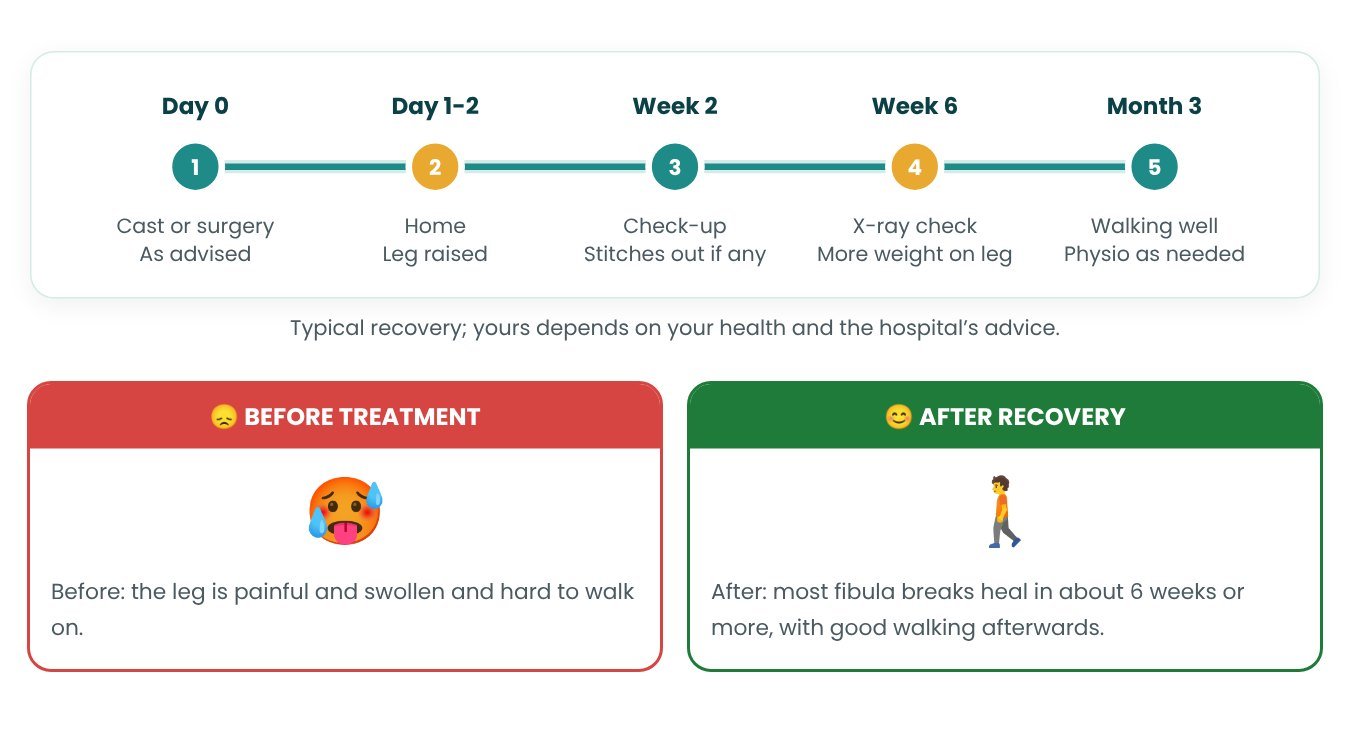 Recovery timeline after Fibula Fracture Treatment