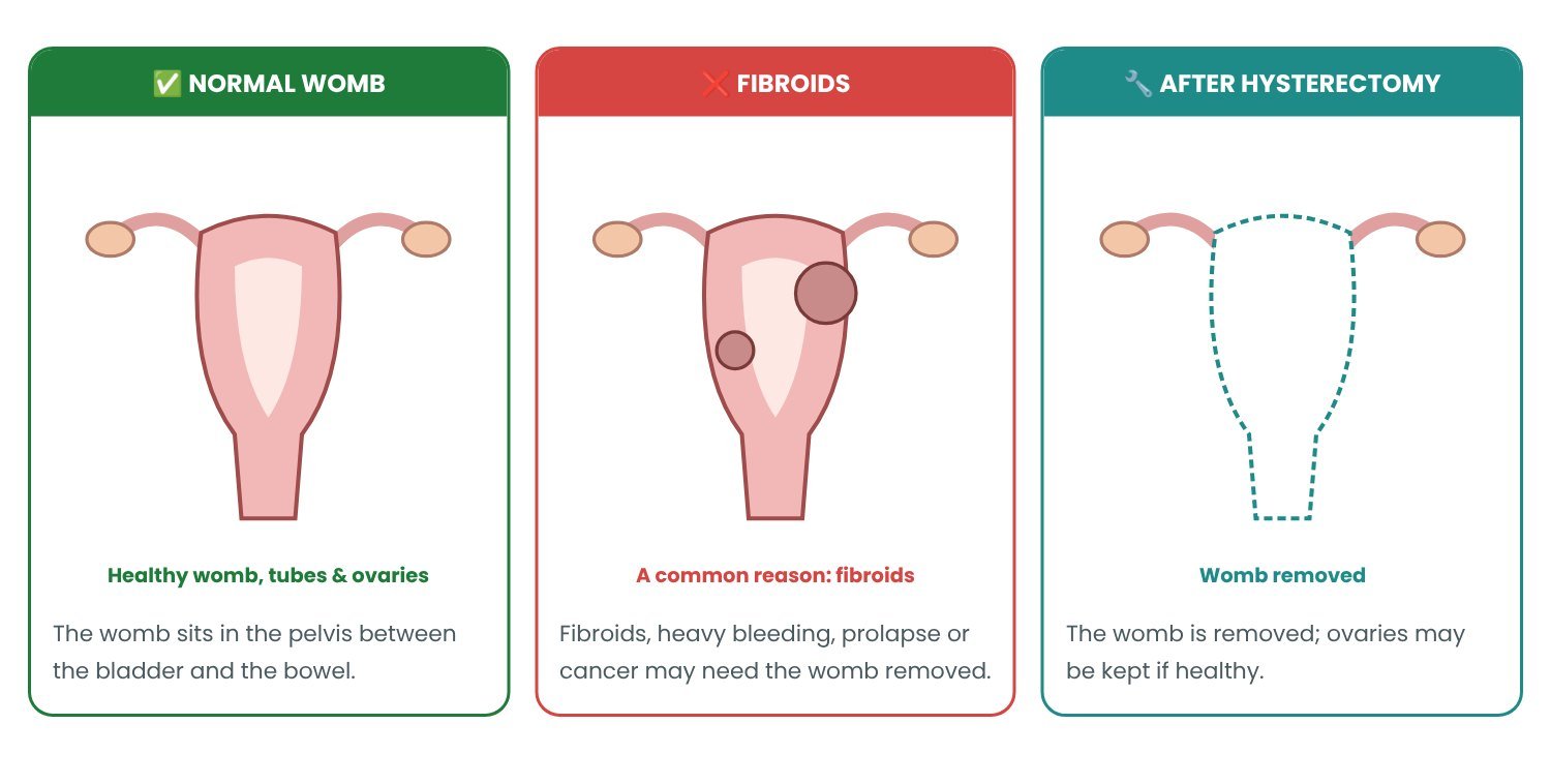 Hysterectomy: normal vs abnormal explained in pictures Hysterectomy: normal vs abnormal explained in pictures