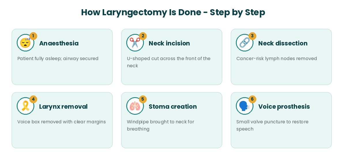 Laryngectomy procedure steps