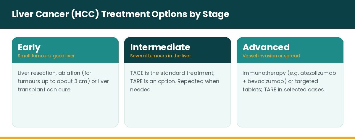 Liver cancer HCC treatment options by stage: resection, ablation, transplant, TACE, TARE, immunotherapy