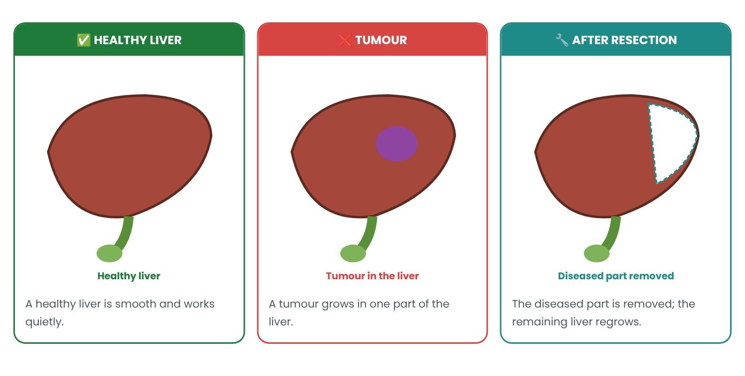 Liver Resection: normal vs abnormal explained in pictures